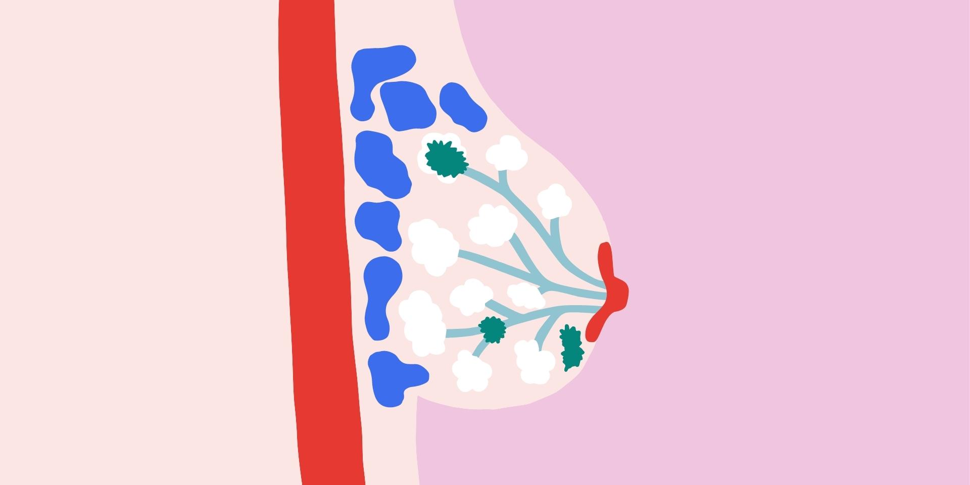 Cancer du sein - Guide complet | Ménopause Club